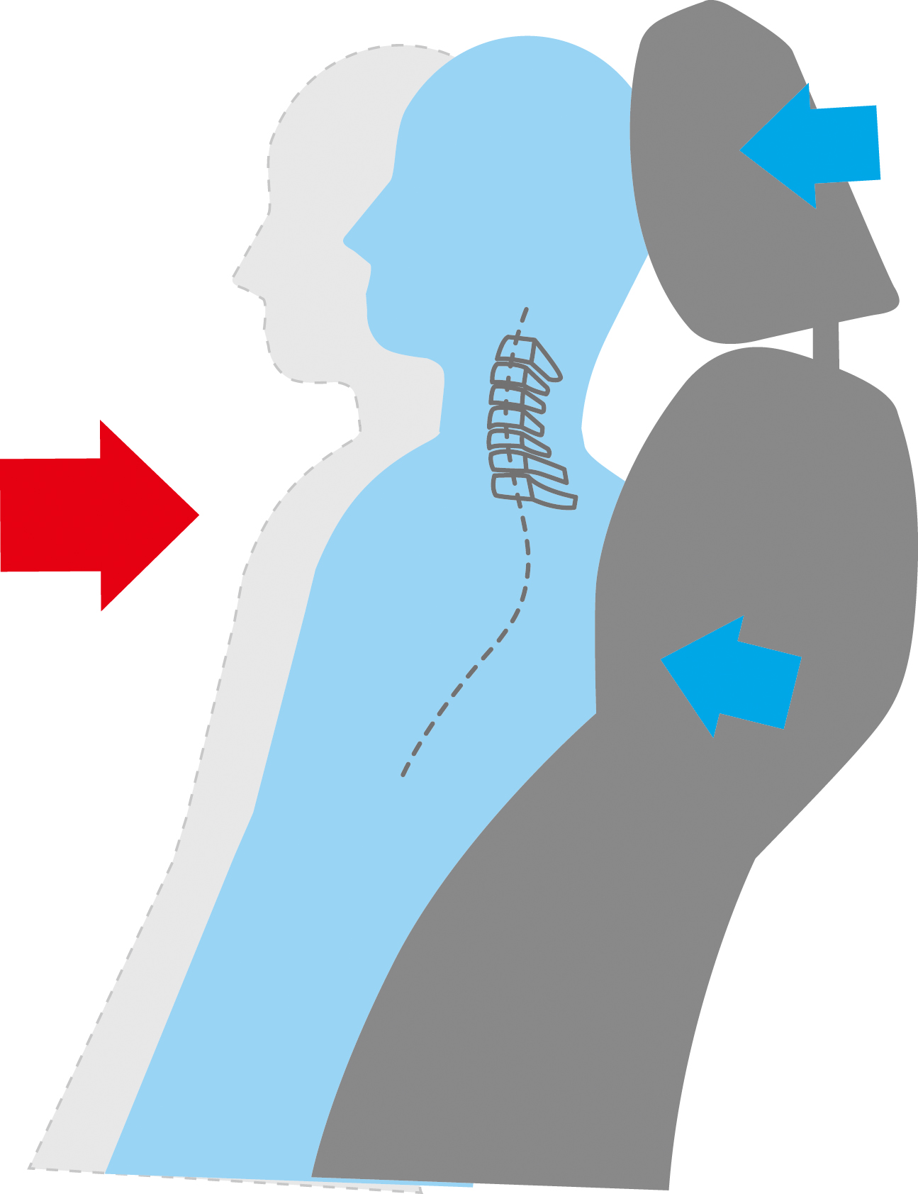 Asientos delanteros que reducen el latigazo cervical